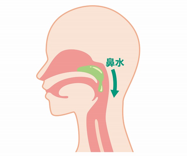 後鼻漏（こうびろう）とは？