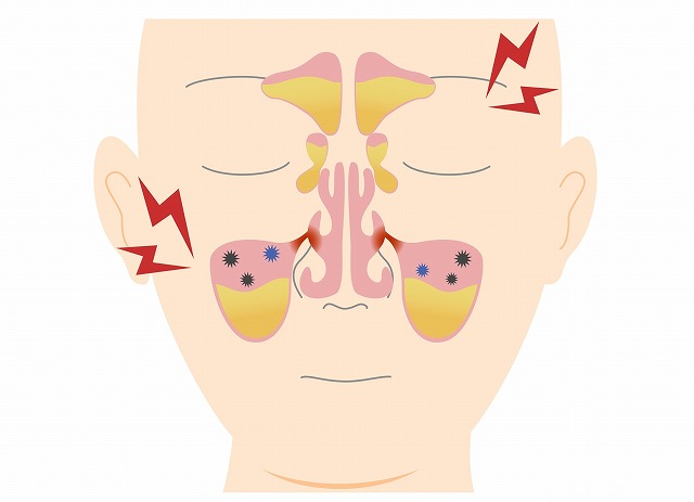膿が溜まる部位によって痛む箇所が異なる