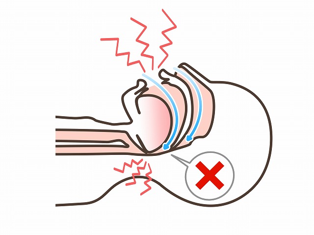 閉塞性睡眠時無呼吸(OSA)